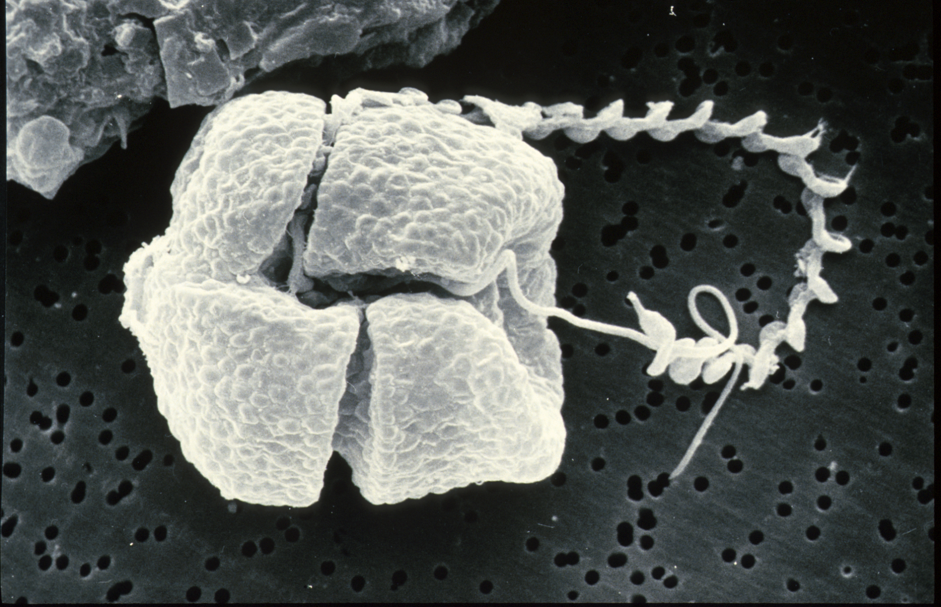 ไดโนแฟลกเจลเลต (Dinoflagellates/ไดโน) ในตู้รีฟ: รู้จัก แยกจากไดอะตอม และวิธีกำจัดให้หายจริง